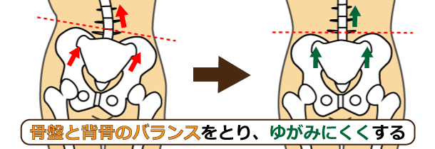 骨盤と背骨のバランスを取りゆがみにくい
